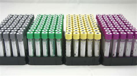 qft elisa kit|qft plus blood test.